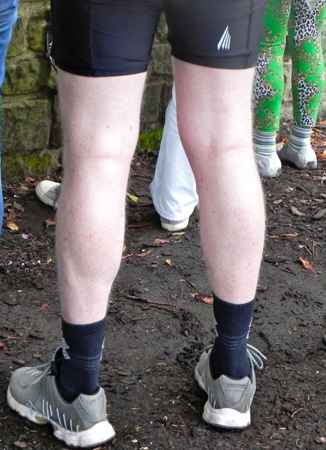 Dem jungen Mann hat Didi Dynamite die Hose weggesprengt...